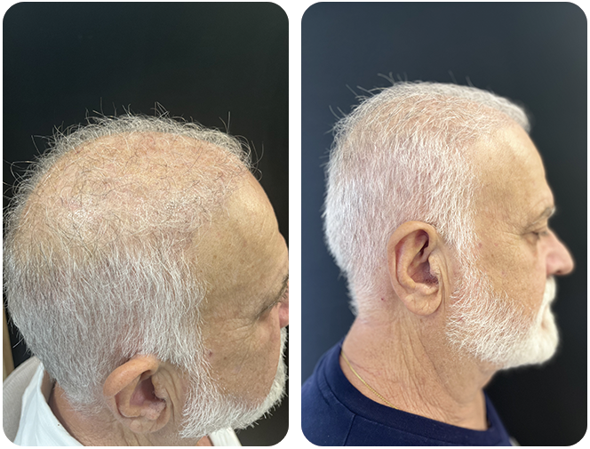 antes-depois1