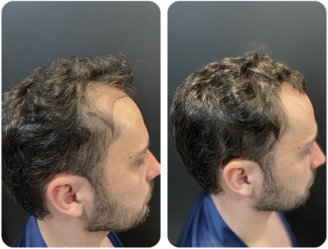 antes-depois2