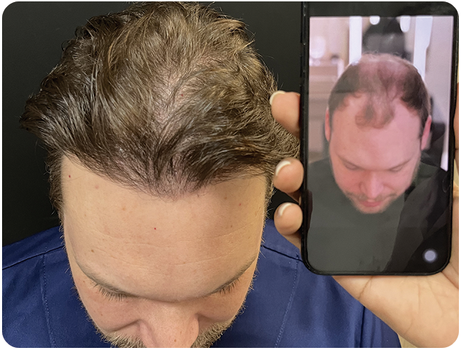 antes-depois3