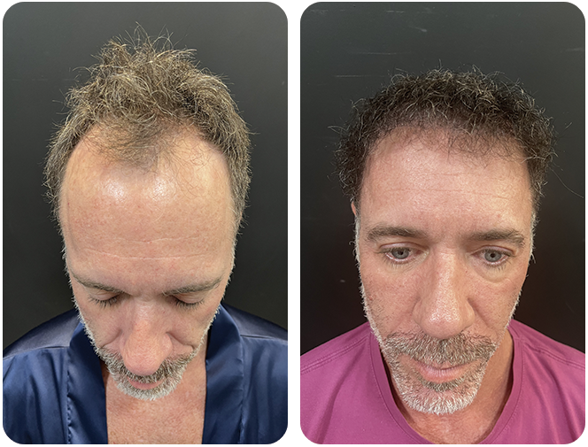 antes-depois4
